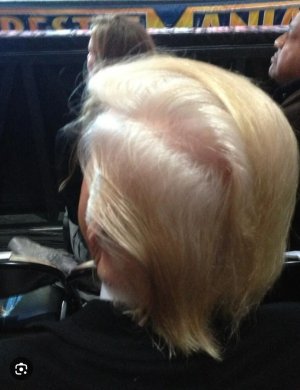 Trump balding.jpg
