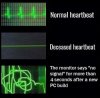 heartbeat.jpg