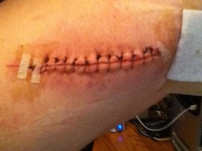 stitches.JPG